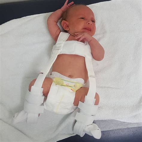 Hip Dysplasia Awareness month - Parent Daze