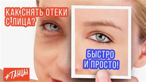 Как избавиться от отеков на лице. Экспресс-метод от Ксении Корнейчук ...