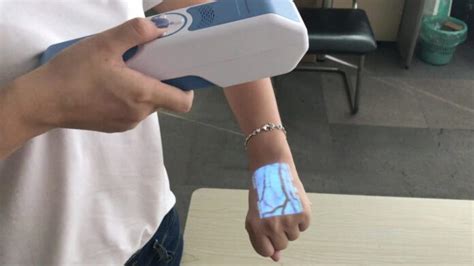 Can Vein Finder Displays Veins beneath the Surface? | Healthcare ...
