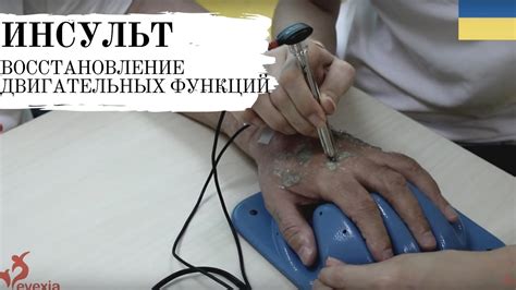 Отзыв пациента после инсульта - YouTube