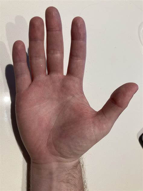 Mole on right hand meaning - catholiclasopa
