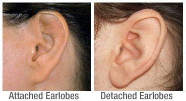 Do you have attached or detached earlobes? | IGN Boards