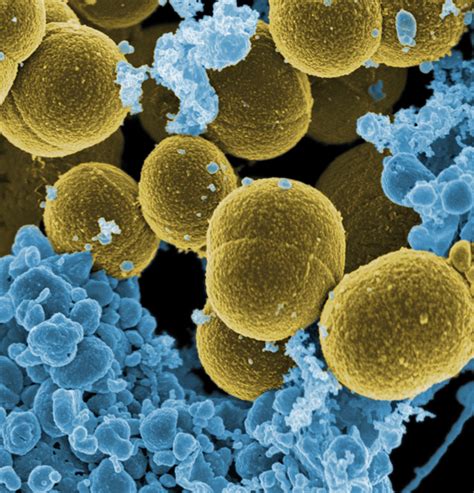 Staphylococcus aureus - Wikipedia, la enciclopedia libre