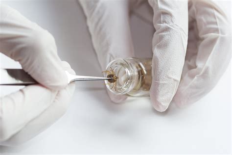 How To Properly Remove A Tick From A Child