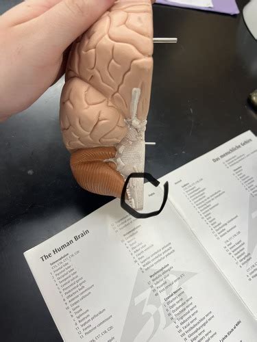 Brain Practical Flashcards | Quizlet 