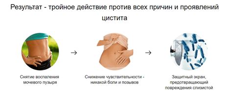 Цистерол от цистита: отзывы и цена таблеток, где купить