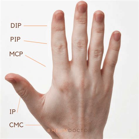 Hand anatomy #2 - RheumDoctor