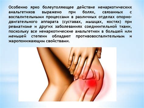 Анальгетики. Применение - презентация онлайн
