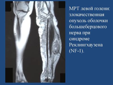 Моногенные заболевания - презентация онлайн