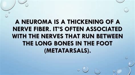 What is a Neuroma? - YouTube