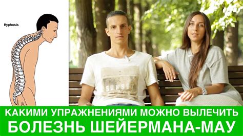 Болезнь Шейермана - Мау и упражнения для осанки - YouTube