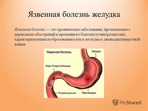 Презентация на тему: "Государственное бюджетное профессиональное ...