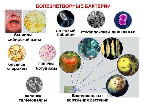 БАКТЕРИИ ИХ СТРОЕНИЕ И ЖИЗНЕДЕЯТЕЛЬНОСТЬ БАКТЕРИИ