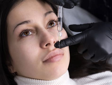 lip flip  lips   evolve med spa