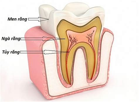 Cách điều trị tủy răng chưa đóng chóp an toàn và hiệu quả