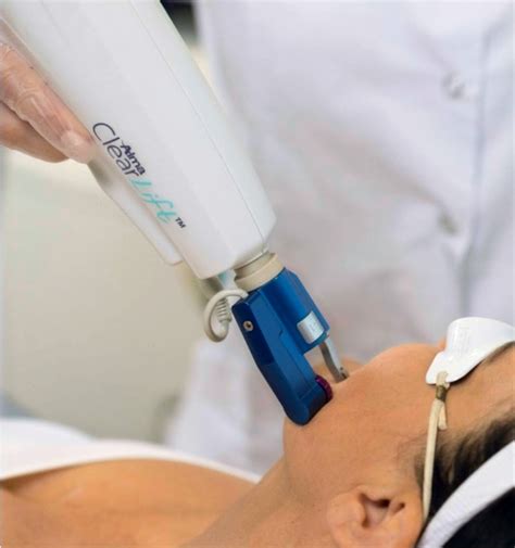 Laser Treatment Of Hyperpigmentation | viplaserclinicmedspa