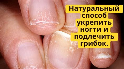 Натуральный способ укрепить ногти и подлечить грибок! Ванночка для ...
