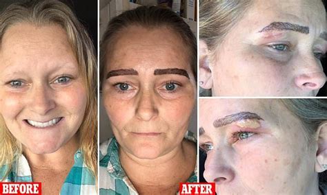 Woman shares horrifying images of her botched microblading procedure ...