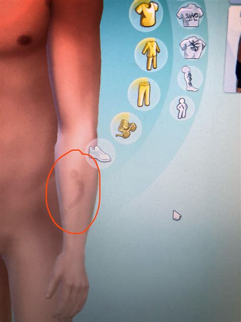 My sim has a random (faded) bite mark on his left arm. I didn't put the