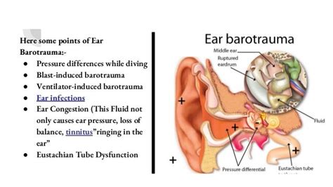 Ear barotrauma causes, symptoms and treatment