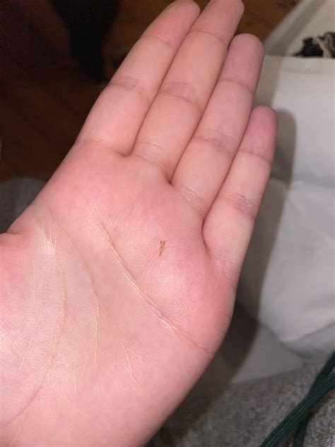 carpet beetle? Bed bugs? Both? : r/carpetbeetles