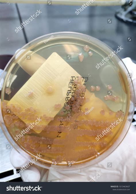 Morganella Morganii Sample Culture Microbiology Stock Photo 1613463607 ...