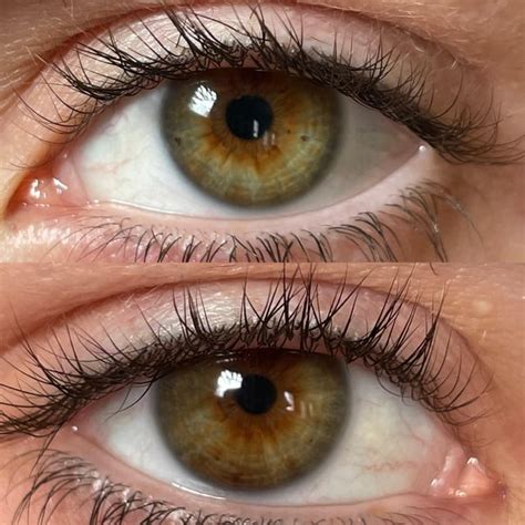 Hazel or Central Heterochromia? : r/eyes