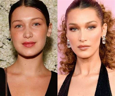 Here's what it was before the operation: the beautiful woman of the ...