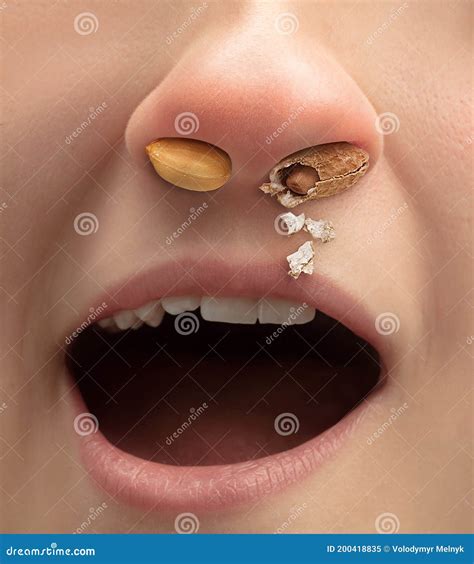 Runny Nose