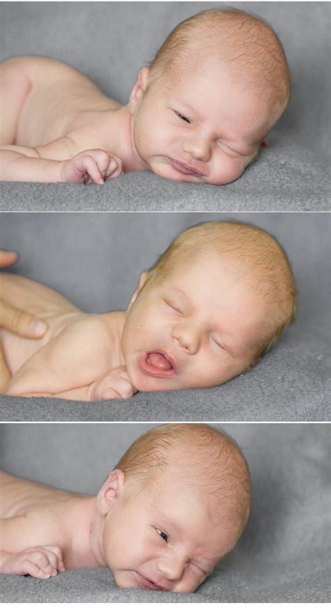 Baby’s Hair on Ultrasound vs. When Born: Mind-Blowing Revelation