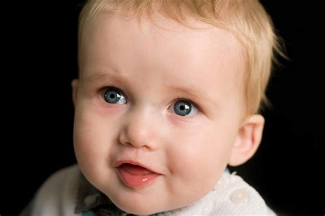 Digeorge Syndrome 22q11 2 Deletion Syndrome Symptoms - vrogue.co