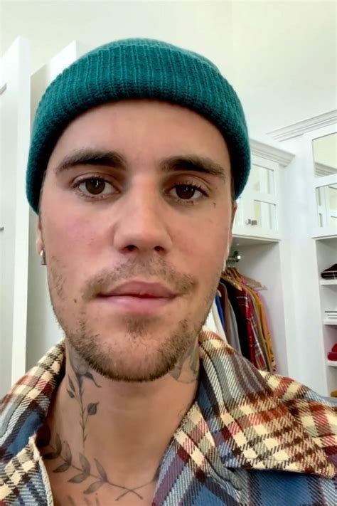 Justin Bieber shares update after revealing face is paralyzed