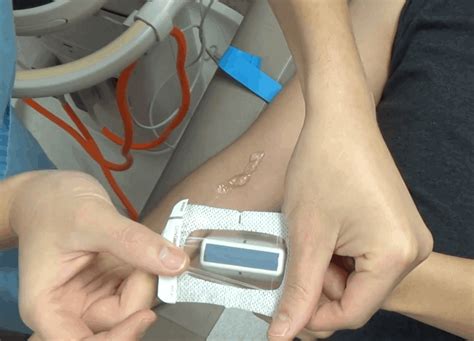 Ultrasound Guided Peripheral IV Placement STEP BY STEP, 58% OFF