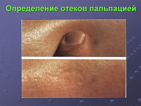 Методы пальпации, перкуссии и аускультации в диагностике заболеваний ...