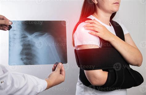The doctor holds in his hand a medical x-ray of a dislocated humerus