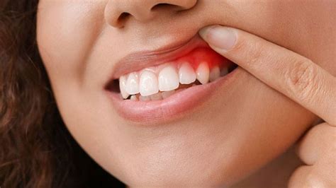 How a Saltwater Rinse Can Improve Your Oral Health – Page 4 – Entirely ...