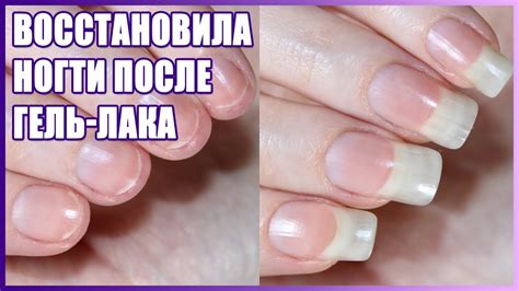 Как восстановить ногти после гель лака и наращивания - YouTube