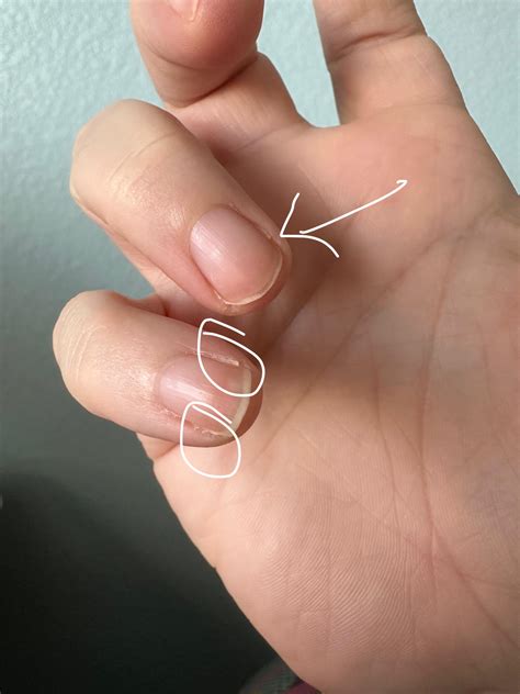Why do my nails have sideburns and how do I get rid of them 😩 : r/Nails