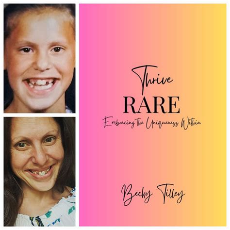 Know Rare