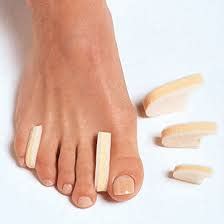 bunion toe treatment olwen hospital