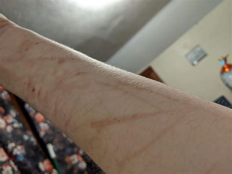 healed faster than expected : r/SelfHarmScars