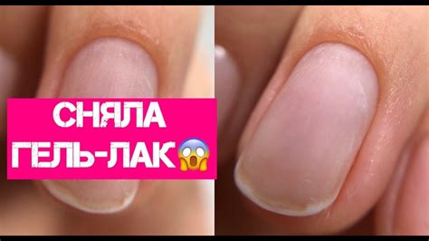 СНЯТИЕ ГЕЛЬ-ЛАКА ПОЛНОСТЬЮ. Что с ногтями после снятия?😱 - YouTube