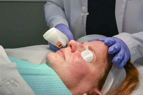 Improve Your Skin with Intense Pulsed Light Therapy | Peninsula Dermatology