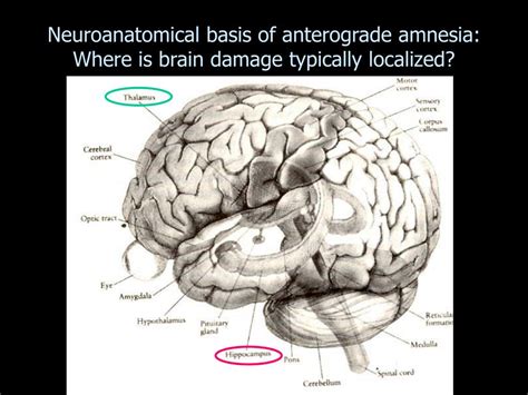 unveiling implicit memory insights  amnesia studies
