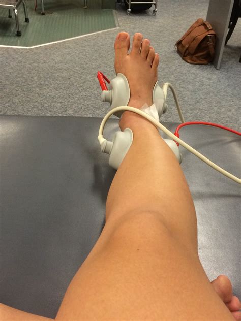 high ankle sprain | My Brostrum Repair