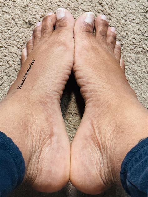 Crunchy, Crusty Feet & Toes : r/feetpicsbuyerandsell