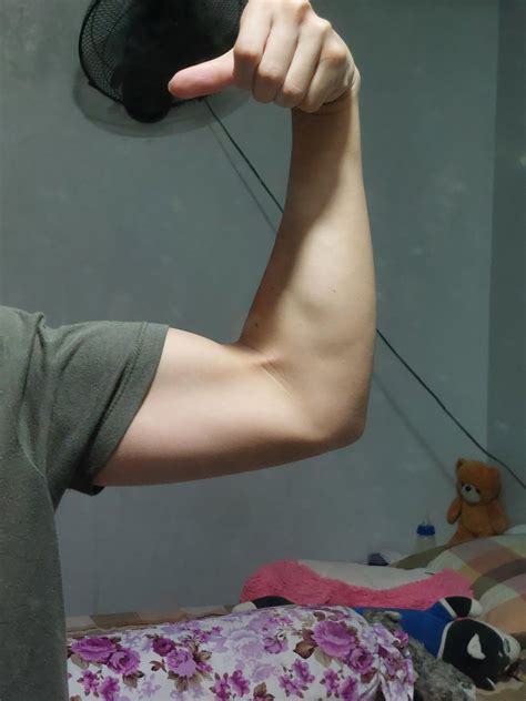 Other arm's bicep tendon more visible than the other, should I be