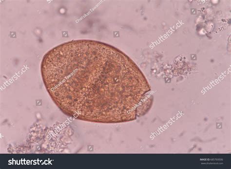Intestinal Flukes Egg Stool Human Stock Photo (Edit Now) 685769506