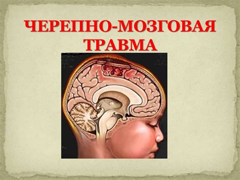 Черепно-мозговая травма - презентация онлайн