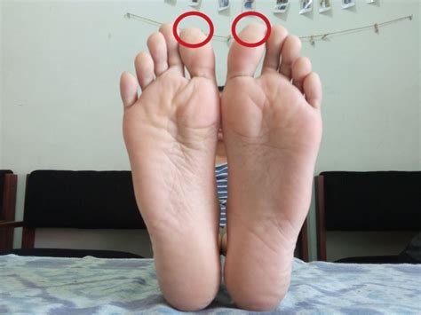 7 Titik Akupuntur Refleksi Kaki untuk Kesehatanmu